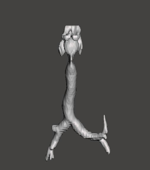 Trachea and bronchi