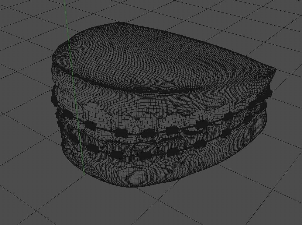 Fake Teeth And Braces 3D model | CGTrader