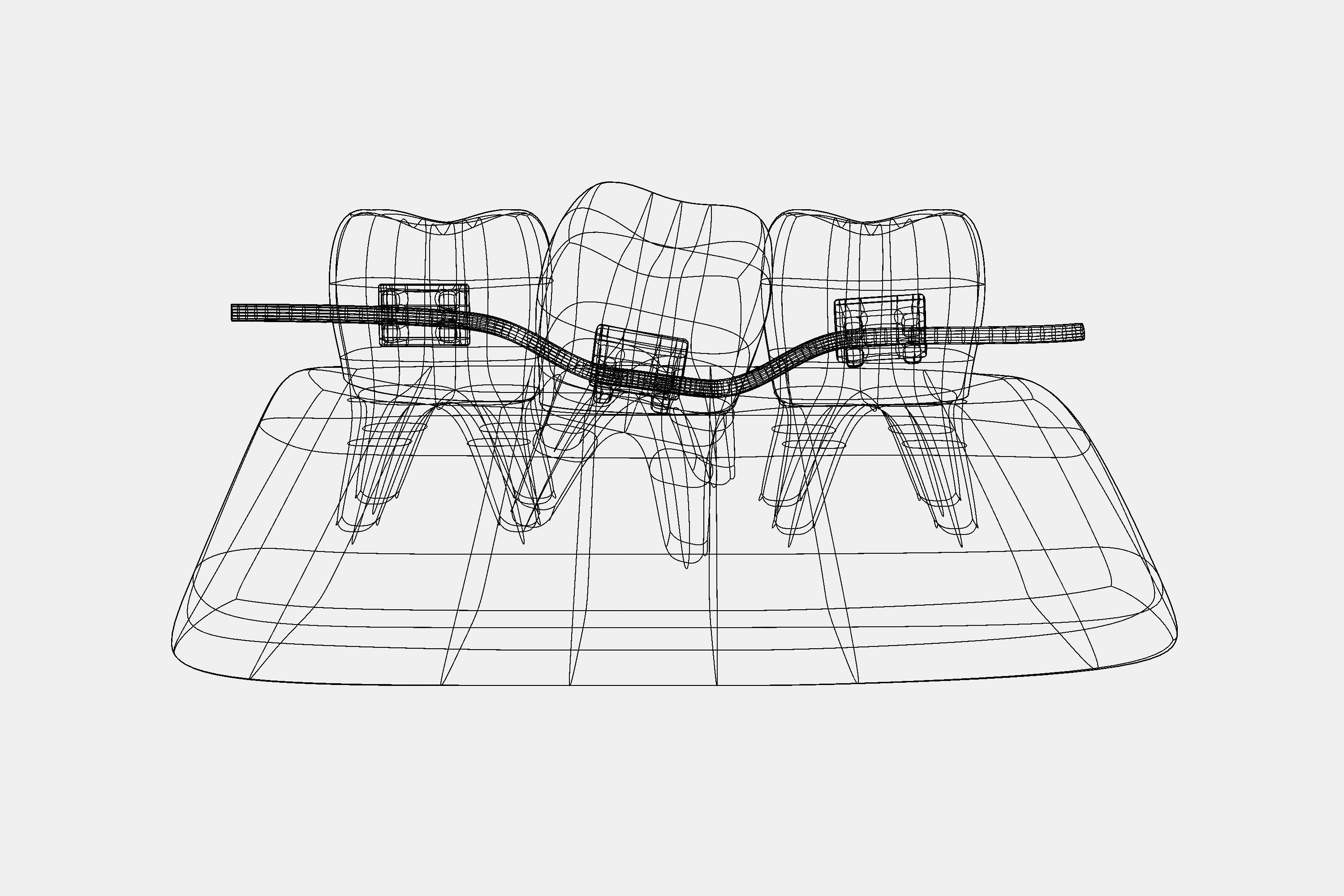 Dental braces system for bite correction 3D model | CGTrader